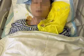海南3人吃癞蛤蟆中毒致1死 癞蛤蟆黏液有剧毒不可随意食用图片