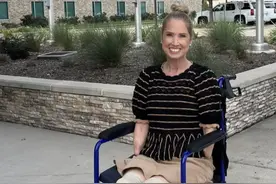 美国一女子感冒发烧后四肢变黑 结果被迫截肢图片