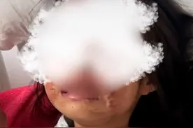 六岁女童被六年级男生泼开水，教育局回应系“恶作剧”，女童家属怒斥不实：是校园霸凌图片