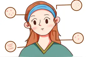 应对秋季常见的皮肤问题，长宁医生“划重点”图片