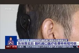 科幻照进现实 脑机接口如何守护生命？图片