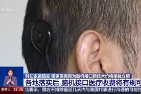 科幻照进现实 脑机接口如何守护生命？图片