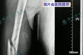 两男子挑战机器人“掰手腕”，当场双双骨折图片