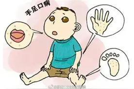 家中孩子得了手足口，家长应该怎么照顾孩子的饮食？图片