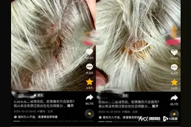 在欧莱雅旗舰店漂染发却造成头皮二度烧伤？门店：协商沟通中图片