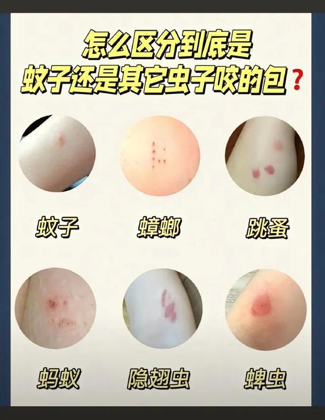头皮发麻！蟑螂会咬人？专家说……