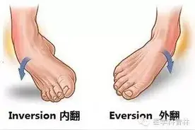 临床医生说科普丨“崴脚”了该怎么办？图片