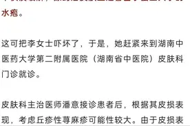 小心凉席！长沙女子双下肢起红斑、风团、水疱！图片