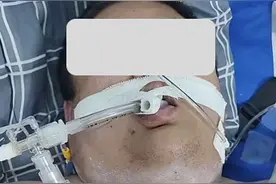 29岁快递公司主管在宿舍脑干出血，抢救3天不幸离世，相关方回应：是否属于工伤需做鉴定图片