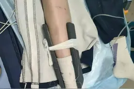 一人身亡，深圳多名学生骑电动车发生意外图片