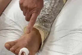 开门就被蛇咬，杭州女子蒙了！消防紧急提醒：这些方法都不靠谱！图片