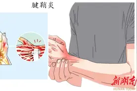 别让腱鞘炎缠上你的手！这些知识一定要知道图片