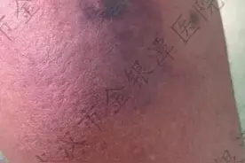 武汉这间24小时门诊，不到3天一台手术！医生提醒→图片