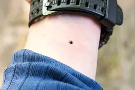 假期外出不慎被蜱虫叮咬怎么办？专家：千万不要用手直接抓图片