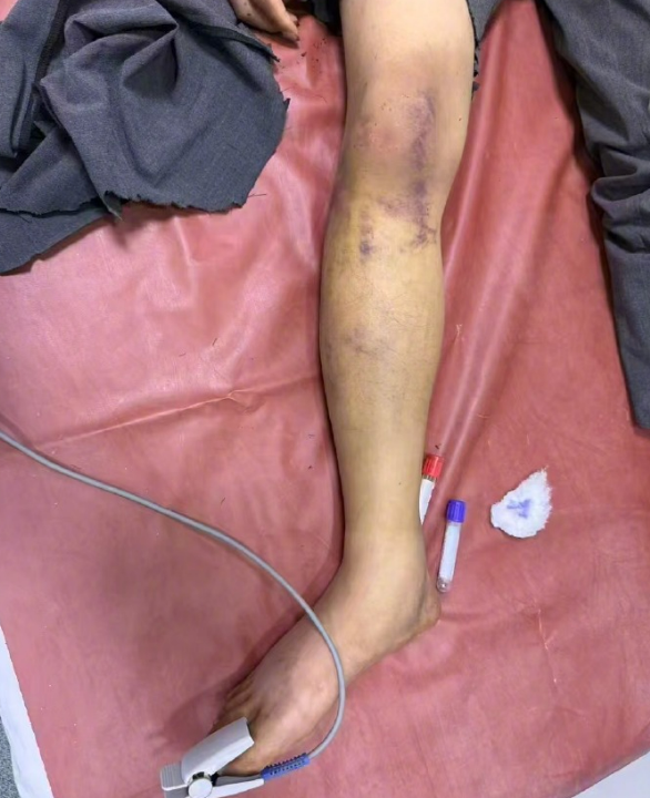 网红在非洲遭绑架打断手脚，另一名中国博主被捕