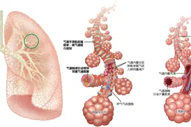 山东省健康科普专栏丨宝宝感冒有“喘息”，就是哮喘吗？图片