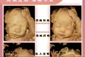 一张四维彩超图就能预测胎儿长相？娱乐即可，不能全信图片