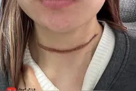 女生参加自行车比赛被风筝线割喉，主办方拿“免责协议”说事显得无知图片