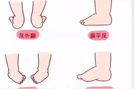 这种网红拖鞋很多人在穿，可能正在毁掉你的脚图片