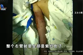 上海6岁男孩意外死亡，在酒店游泳时手臂被这个“黑洞”死死吸住→图片