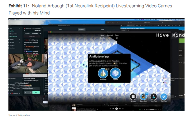 脑机接口——人与AI“共生”