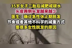 女子二胎后减肥戒碳水头皮两侧的头发数量越来越少，被确诊为急性休止期脱发图片