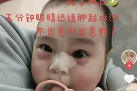 7个月宝宝吃猕猴桃经历“断崖式衰老”，“四岁前不能吃猕猴桃”是真的吗？图片