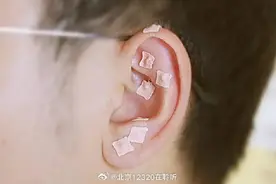 高度近视早干预 中医疗法护眼睛图片