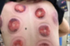 爆火！浙江男子跟风半小时，家人一看吓傻眼！警惕：这事有讲究图片