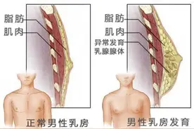 焦虑：男生青春期乳腺发育？图片