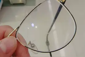 大连女子被突然飞来的球砸中左眼，还有让她更闹心的图片