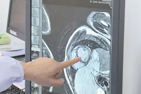 奉贤17岁小伙吃了生冷食物被紧急送医，区中心医院提示这种情况一定要警惕！图片