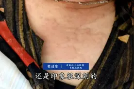 警惕！武汉女子喝水喝“毁容”，还有很多人在这样做……图片