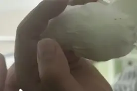 太恐怖！男子一个小动作被夹断手指，无法续接，“元凶”竟是它！很多人家中还在用图片