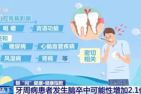 “老掉牙”是必然规律吗？真相出乎意料图片
