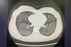 不到一天，7岁女孩几乎“白肺”！很多人夏天都用！图片