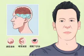 当心！感冒后鼻子流出的可能不全是鼻涕，要警惕这种病图片