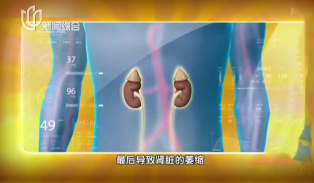 你还在用几块钱的手机壳吗？谨防甲醛、苯、铅超标！