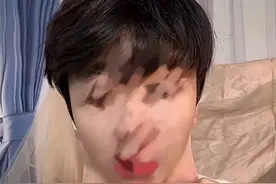 医生谈男子暴瘦110斤后皮肤松弛：皮肤组织蛋白质及脂肪骤减所致，最好四五天减一斤图片