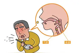 老人喝水吃饭老被呛到？当心吞咽功能障碍！一个表格可家中自测图片