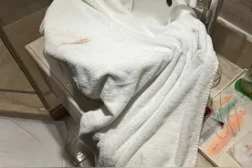 女子擦完全身才发现酒店浴巾上有三处血迹，担心自己被传染病毒，酒店：正处理图片