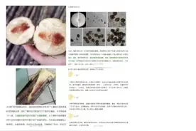 警惕，严重可致死，济南疾控重要提醒图片