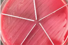 25岁女孩被说“太胖”，使用快速“减肥神器”结果令人崩溃图片