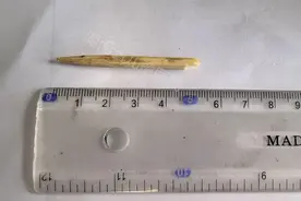 惊险！事发长沙！急刹后，竹签插进2岁男童脸部图片