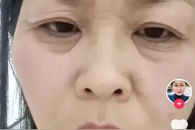 专家谈卵巢早衰：不可逆、重在预防，近年患者呈年轻化趋势图片