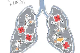 查出肺部小结节咋办？如何调理？看这一篇就够了图片