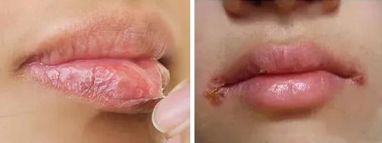 干唇人涂ta算是熬出头！轻薄滋润，一抹get嘟嘟唇，两支才几十块！