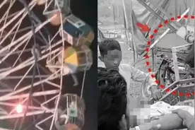 13岁女孩头皮被瞬间扯掉当场昏迷，小心这项娱乐设施图片