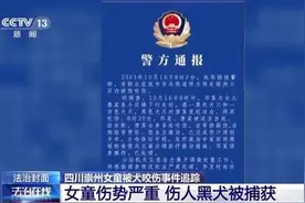 恶犬伤人事件发生 犬主应承担哪些法律责任？图片