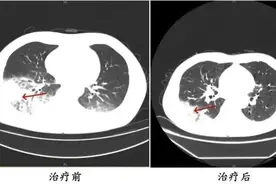 “军团菌”藏身空调，多人中招！紧急提醒→图片